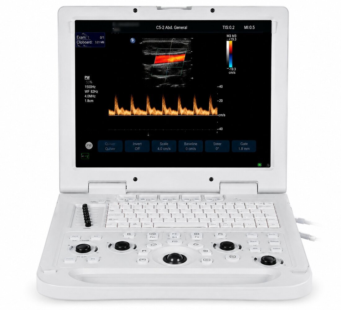 Échographe Doppler couleur portable HUC-190