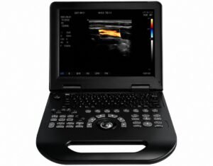 Échographe Doppler couleur portable HUC-200