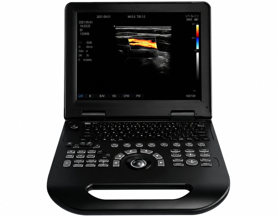 Échographe Doppler couleur portable HUC-200
