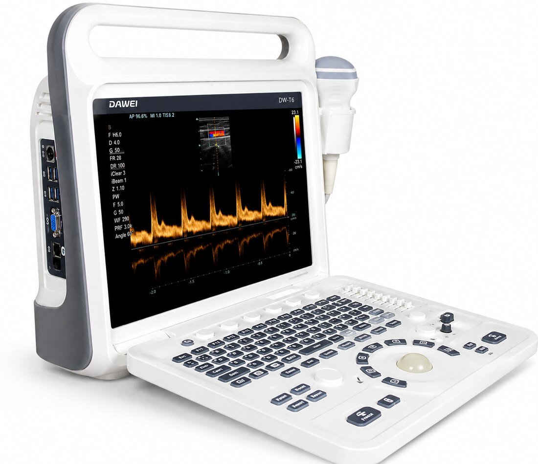 Échographe Doppler couleur portable HUC-280