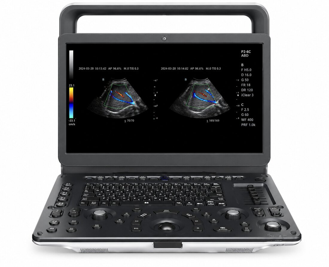 Échographe Doppler couleur HUC-500